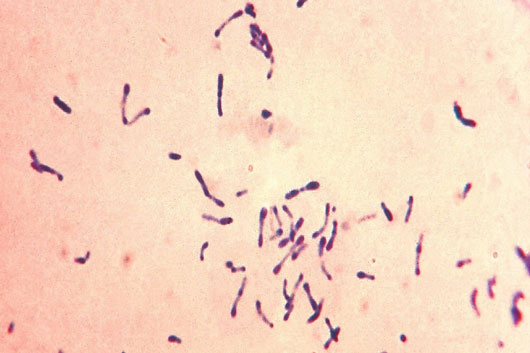 Mueren 25 personas por brote de difteria en Nigeria