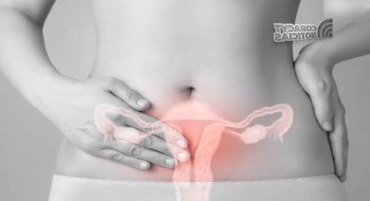 Afecta endometriosis calidad de vida de las mujeres 