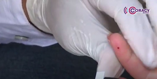 Durante 2024 se detectaron más de 3 mil casos de diabetes 